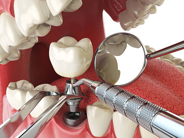 Best Broken Tooth Emergency  in Lake Waynoka, OH